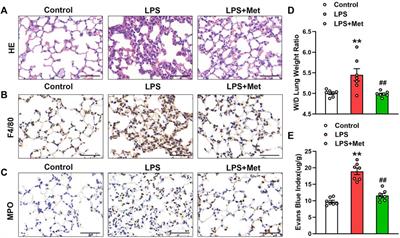 Metformin Alleviates LPS-Induced Acute Lung Injury by Regulating the SIRT1/NF-κB/NLRP3 Pathway and Inhibiting Endothelial Cell Pyroptosis